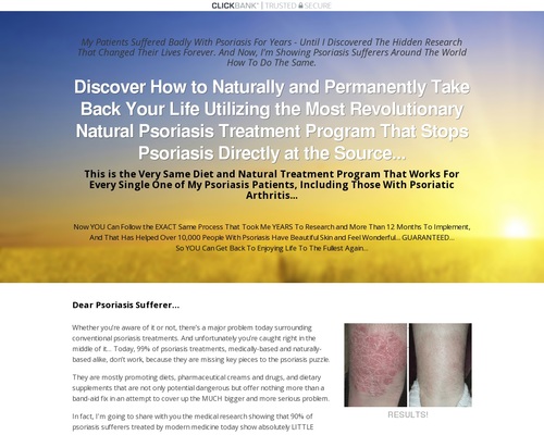 Natural Psoriasis Treatment Program - The Psoriasis Program