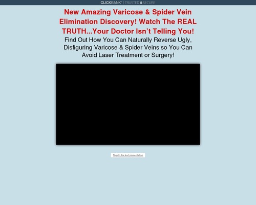 Varicose Veins Natural Treatment | Varicose Veins Home Treatment Program